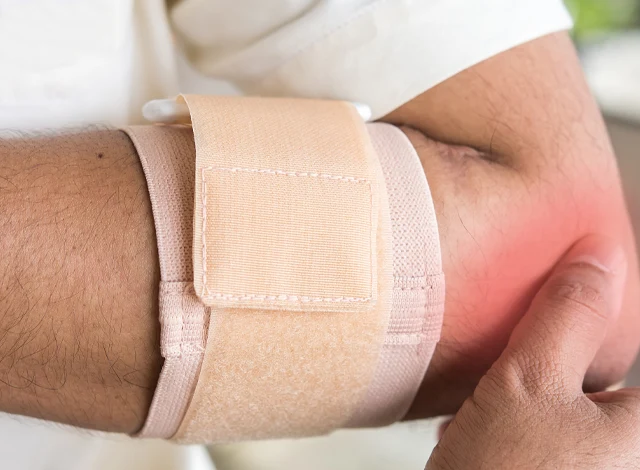 Lateral Epicondylitis
