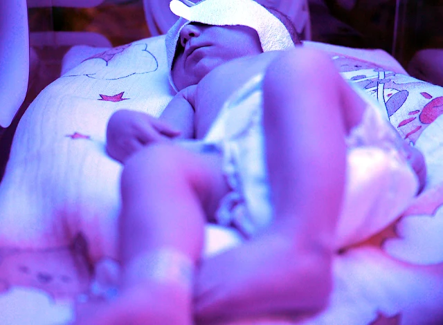 Newborn Brachial Plexus Injuries