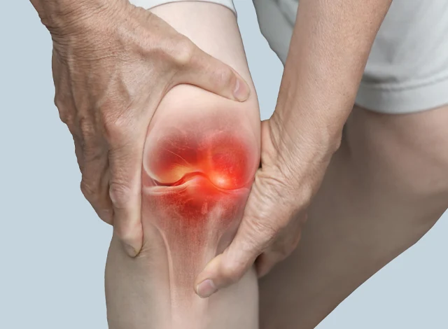 Rheumatoid Arthritis